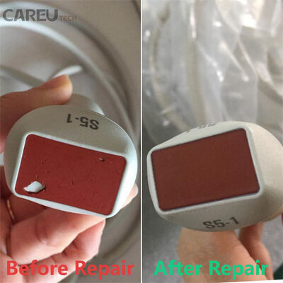 S5-1 sonde échographique à réseau de secteur pour réparation