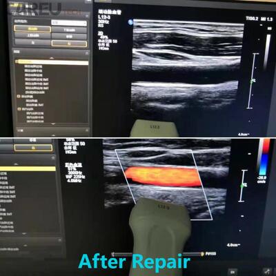 L12-3 sonde à ultrasons pour réparation