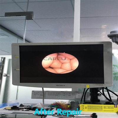 LINVATEC HD 4300 Arthroscope for repair
